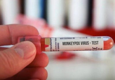 Polandia Laporkan Kasus Pertama Monkeypox